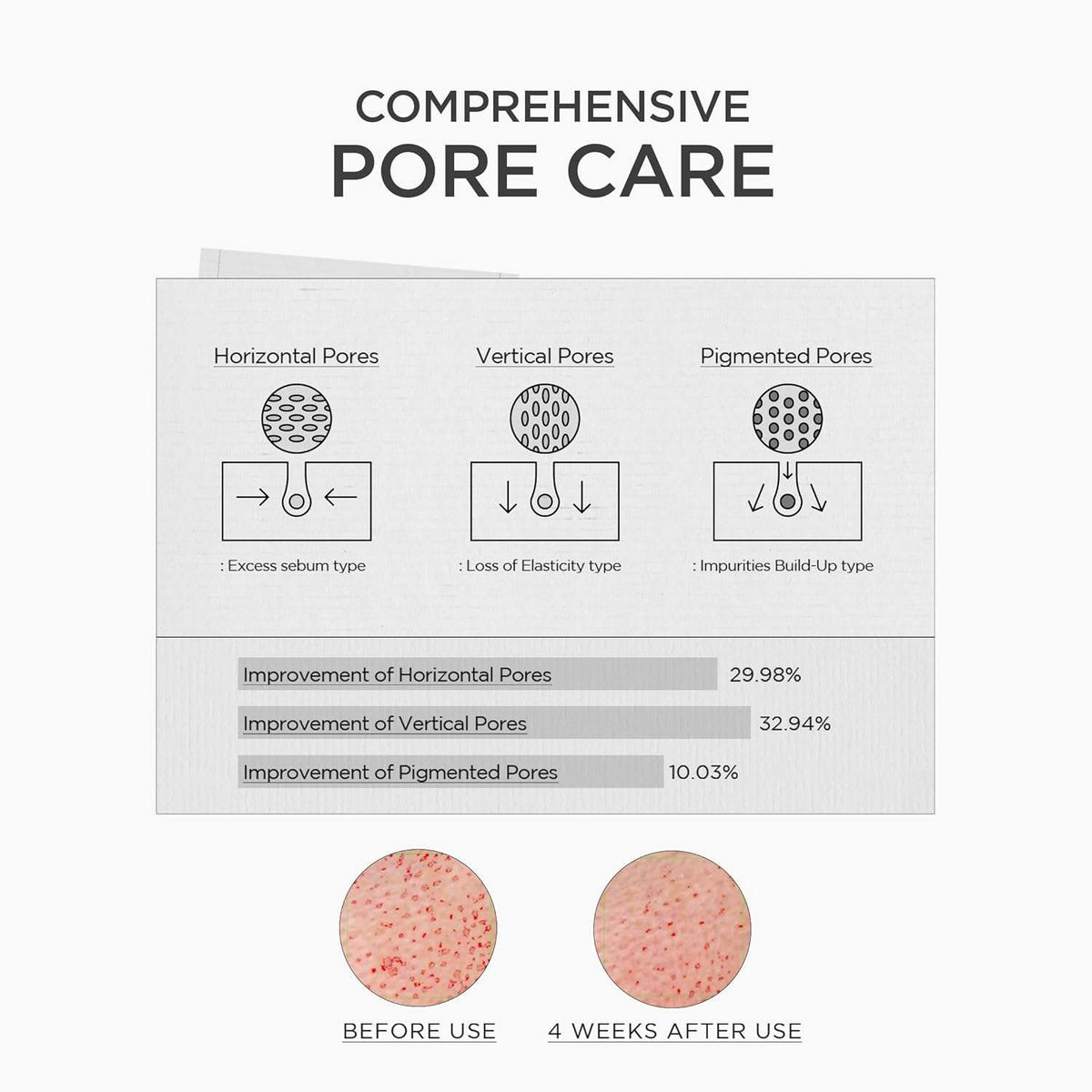 SKIN1004 Niacinamide 10% Boosting Shot Ampoule