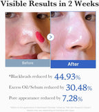 Medicube Zero Pore Pad 2.0