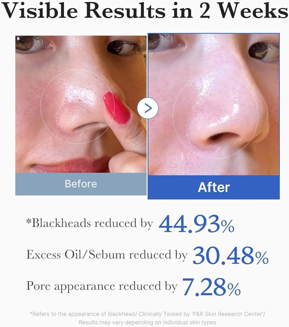 Medicube Zero Pore Pad 2.0