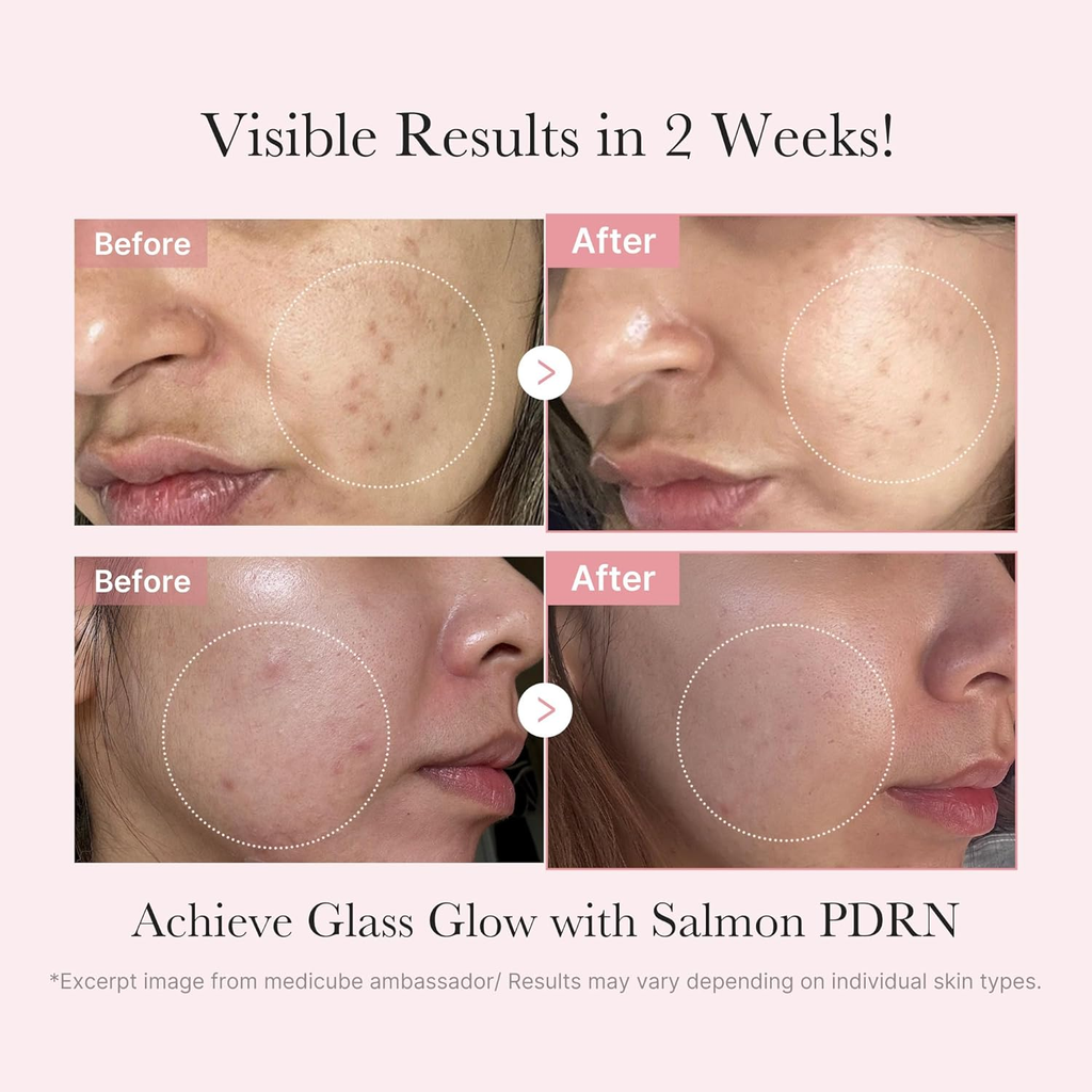 Medicube PDRN Pink Skincare Trial Kit