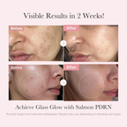 Medicube PDRN Pink Skincare Trial Kit